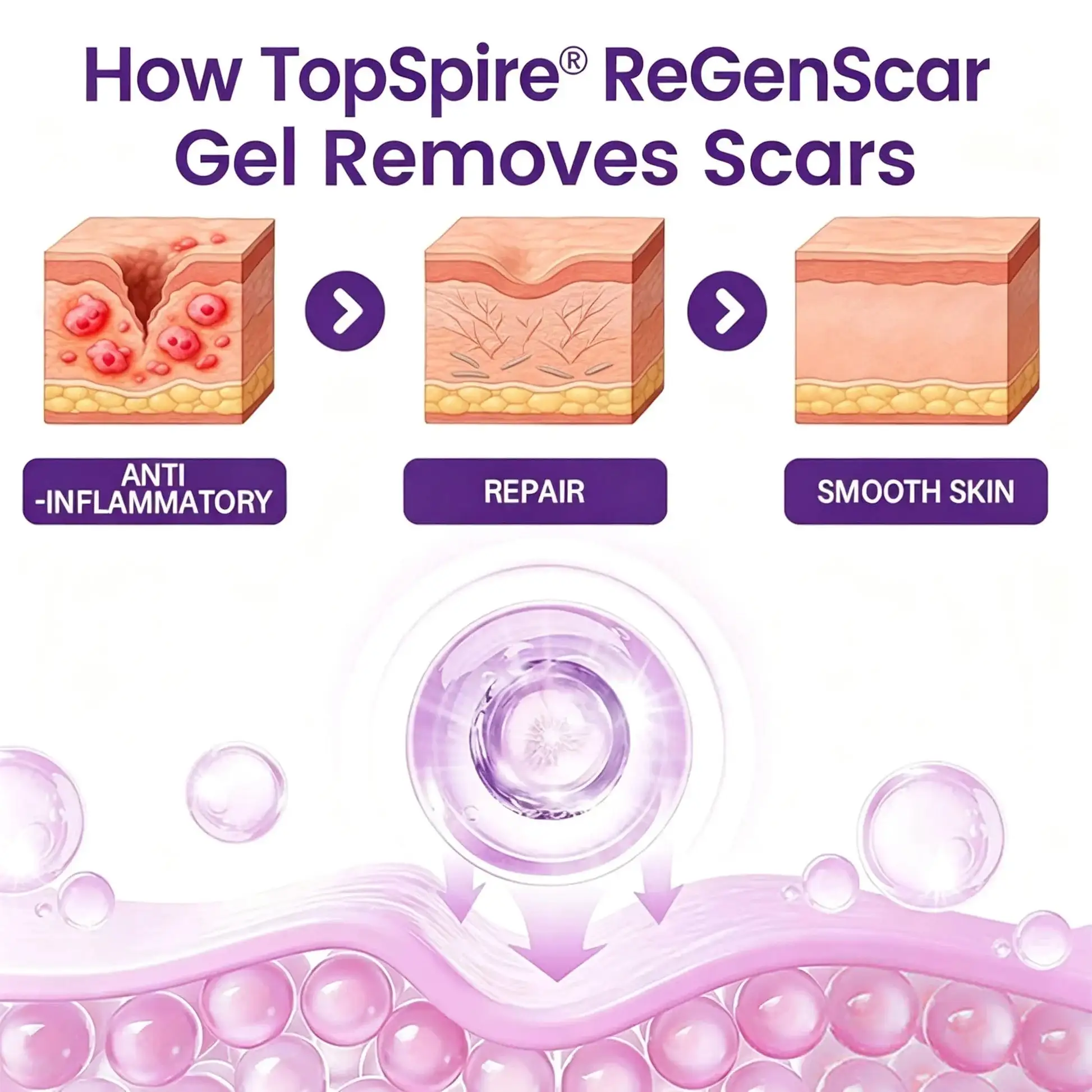 TopSpire® ReGenScar Stem Cell Scar Gel