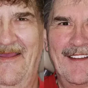 Vaxflite™ PREMIUM DENTURES