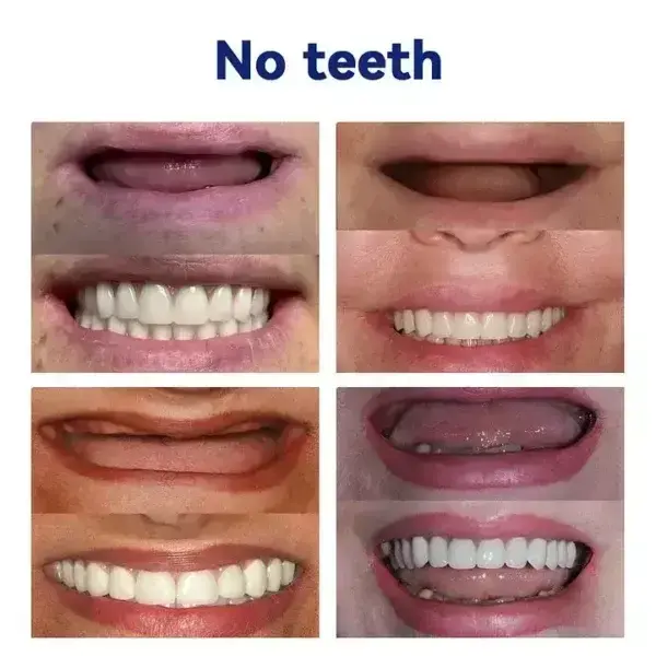 Vaxflite™Advanced Full Denture Set
