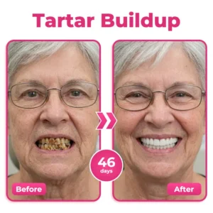 us 🦷 Natravor® Thismile NH-10 Toothpaste Serum for Enamel & Gum Care – Advanced Therapypy