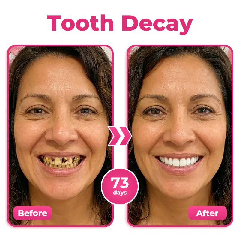 us 🦷 Natravor® Thismile NH-10 Toothpaste Serum for Enamel & Gum Care – Advanced Therapypy