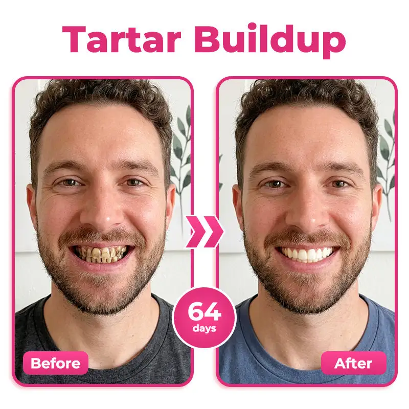 us 🦷 Natravor® Thismile NH-10 Toothpaste Serum for Enamel & Gum Care – Advanced Therapypy