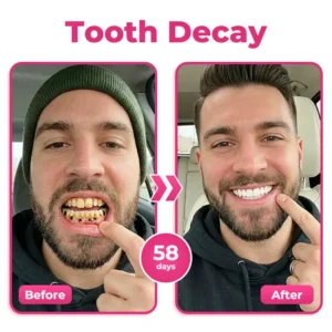 us 🦷 Natravor® Thismile NH-10 Toothpaste Serum for Enamel & Gum Care – Advanced Therapypy