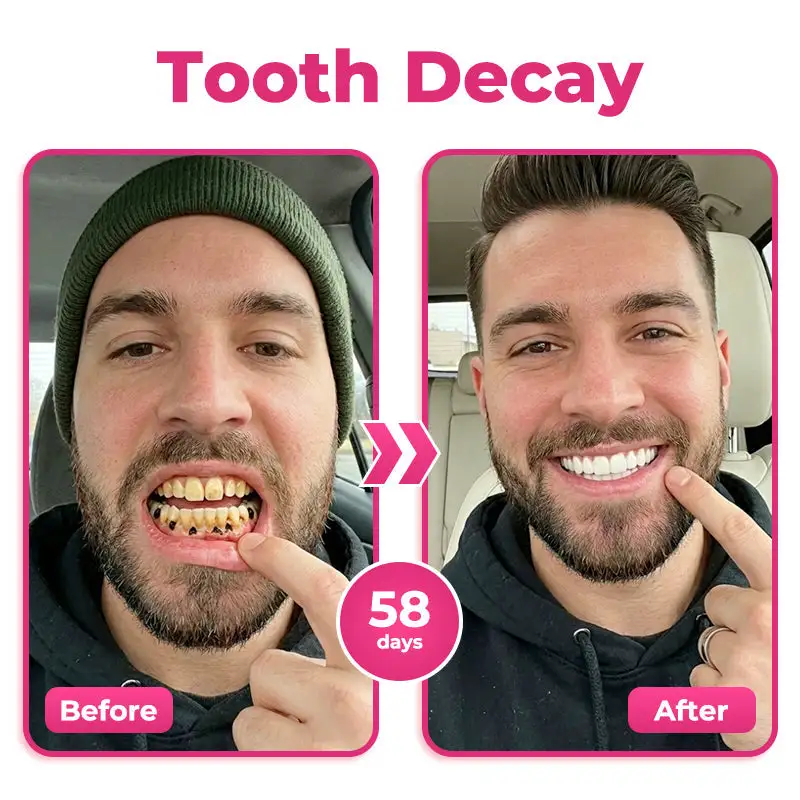 us 🦷 Natravor® Thismile NH-10 Toothpaste Serum for Enamel & Gum Care – Advanced Therapypy