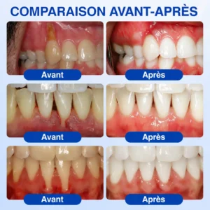 𝑮𝒍𝒊𝒎𝒎𝒆𝒓𝒍𝒚® 𝑮𝒖𝒎𝑹𝒆𝒗𝒊𝒗𝒆 𝑮𝒆𝒍 𝒅𝒆 𝑹é𝒑𝒂𝒓𝒂𝒕𝒊𝒐𝒏 𝑷𝒂𝒓𝒐𝒅𝒐𝒏𝒕𝒂𝒍𝒆