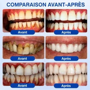 𝑮𝒍𝒊𝒎𝒎𝒆𝒓𝒍𝒚® 𝑮𝒖𝒎𝑹𝒆𝒗𝒊𝒗𝒆 𝑮𝒆𝒍 𝒅𝒆 𝑹é𝒑𝒂𝒓𝒂𝒕𝒊𝒐𝒏 𝑷𝒂𝒓𝒐𝒅𝒐𝒏𝒕𝒂𝒍𝒆