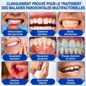 𝑮𝒍𝒊𝒎𝒎𝒆𝒓𝒍𝒚® 𝑮𝒖𝒎𝑹𝒆𝒗𝒊𝒗𝒆 𝑮𝒆𝒍 𝒅𝒆 𝑹é𝒑𝒂𝒓𝒂𝒕𝒊𝒐𝒏 𝑷𝒂𝒓𝒐𝒅𝒐𝒏𝒕𝒂𝒍𝒆