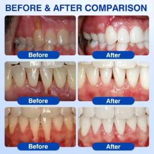 🇺🇸👨⚕️🦷 CureVivo® GumRevive Periodontal Repair Gel⏰⏰