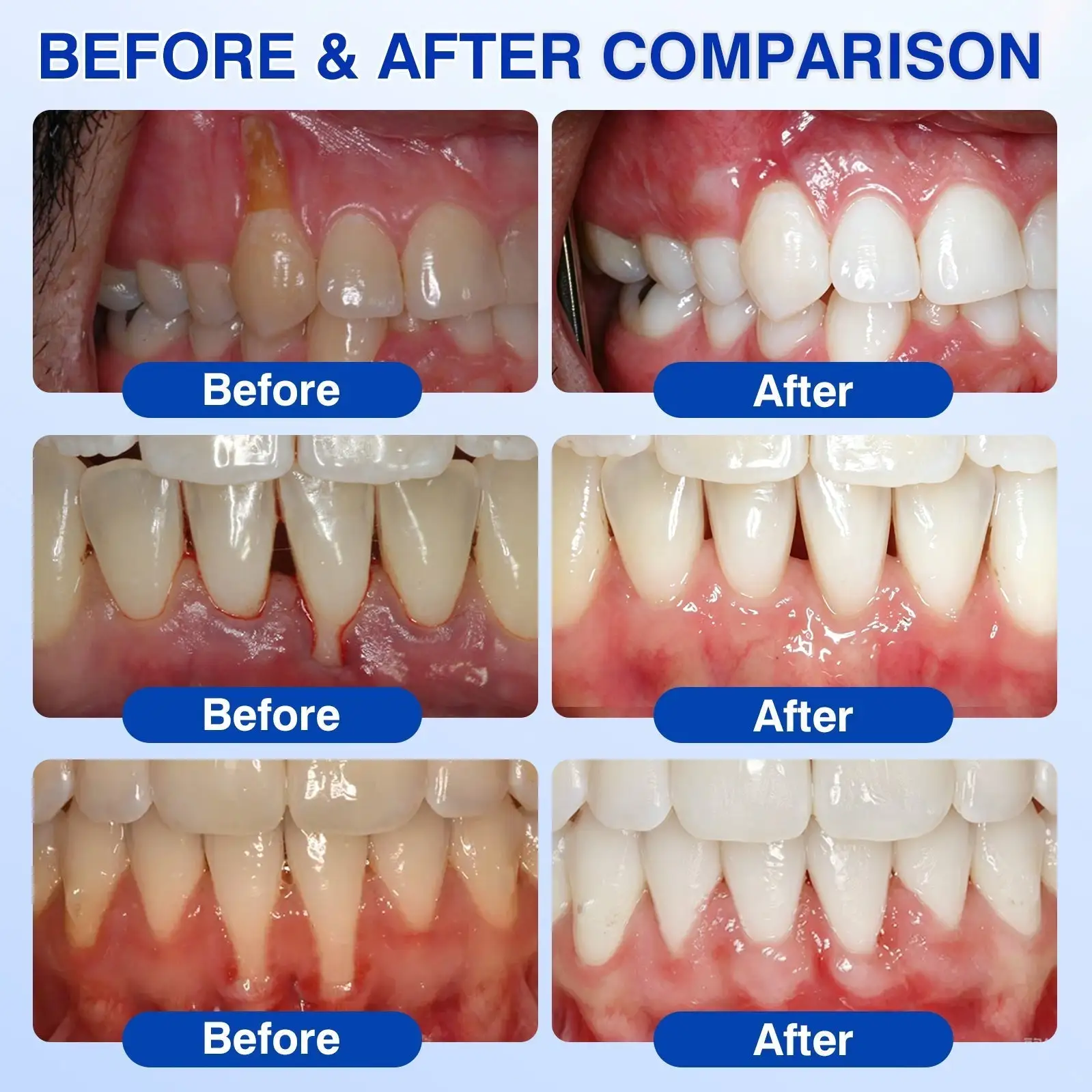 🇺🇸👨⚕️🦷 CureVivo® GumRevive Periodontal Repair Gel⏰⏰