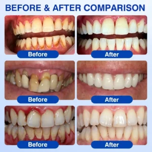 🇺🇸👨⚕️🦷 CureVivo® GumRevive Periodontal Repair Gel⏰⏰