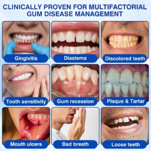 🇺🇸👨⚕️🦷 CureVivo® GumRevive Periodontal Repair Gel⏰⏰