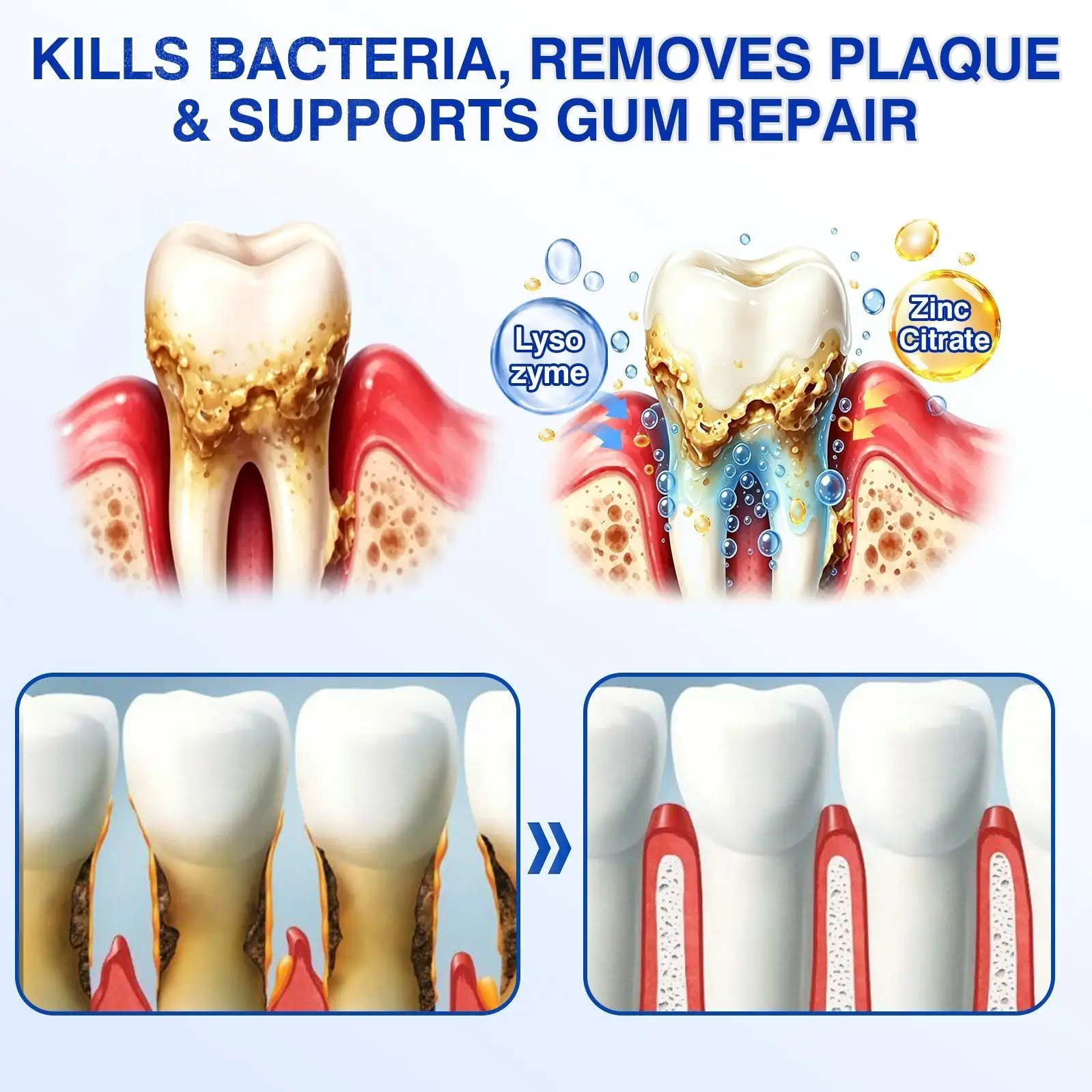 🇺🇸👨⚕️🦷 CureVivo® GumRevive Periodontal Repair Gel⏰⏰