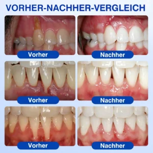 Evolvion® GumRevive Parodontales Reparaturgel