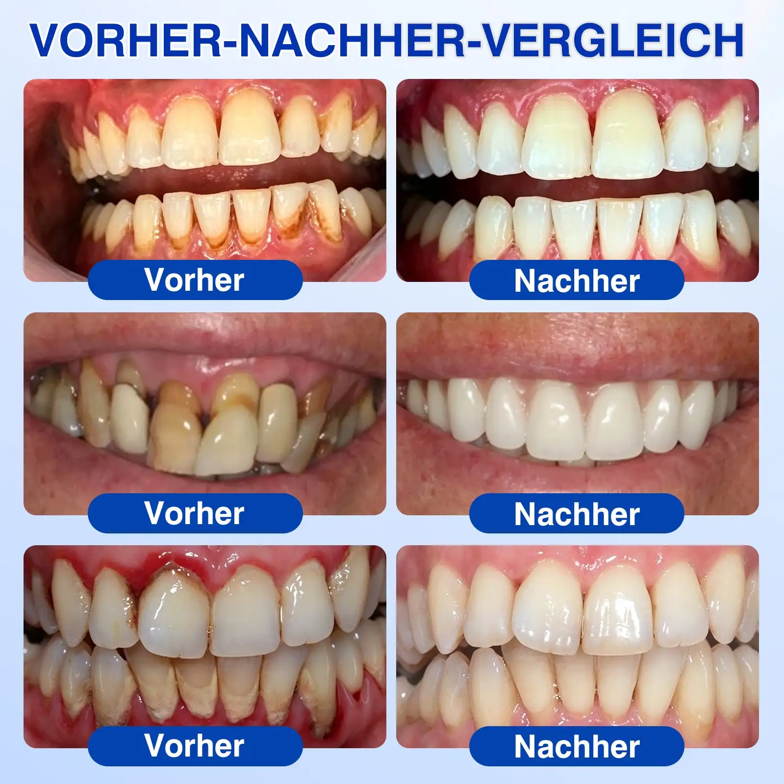 Evolvion® GumRevive Parodontales Reparaturgel