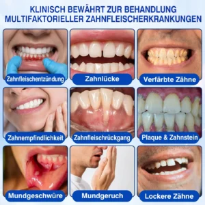 Evolvion® GumRevive Parodontales Reparaturgel