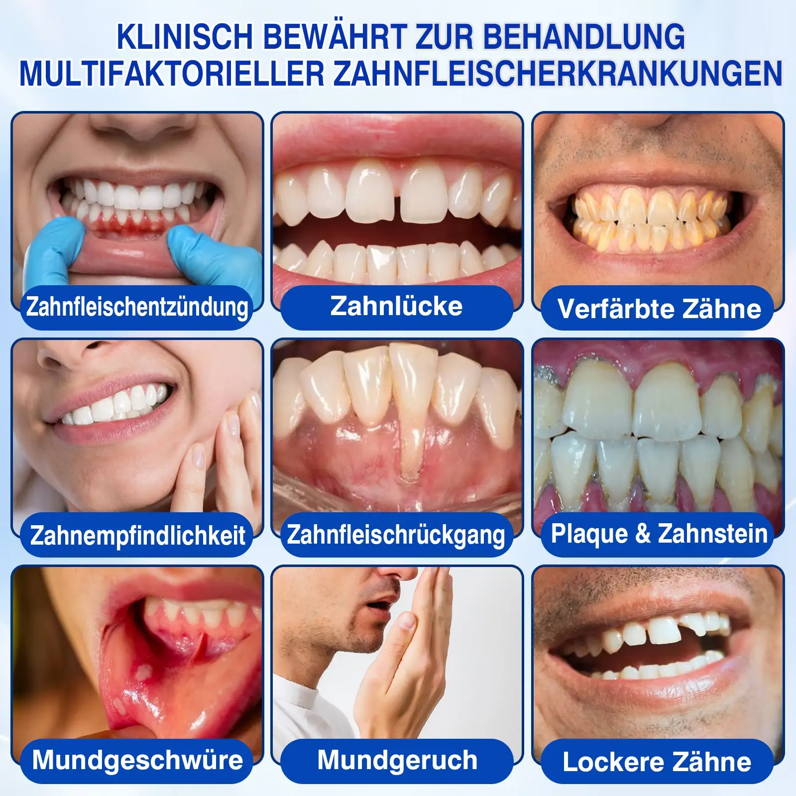 Evolvion® GumRevive Parodontales Reparaturgel