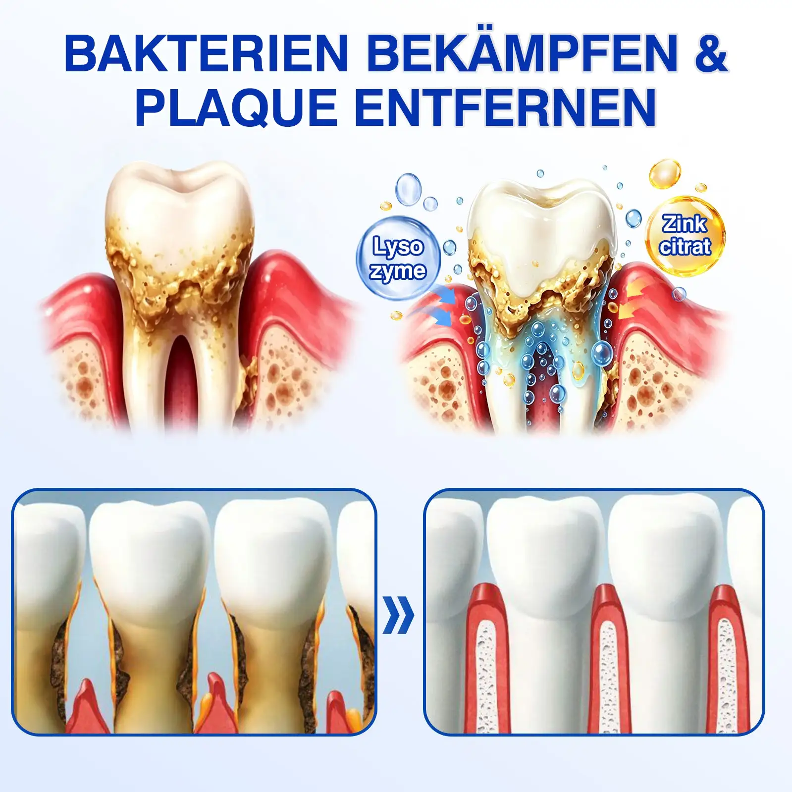 Evolvion® GumRevive Parodontales Reparaturgel