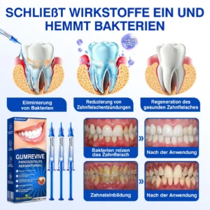 Evolvion® GumRevive Parodontales Reparaturgel