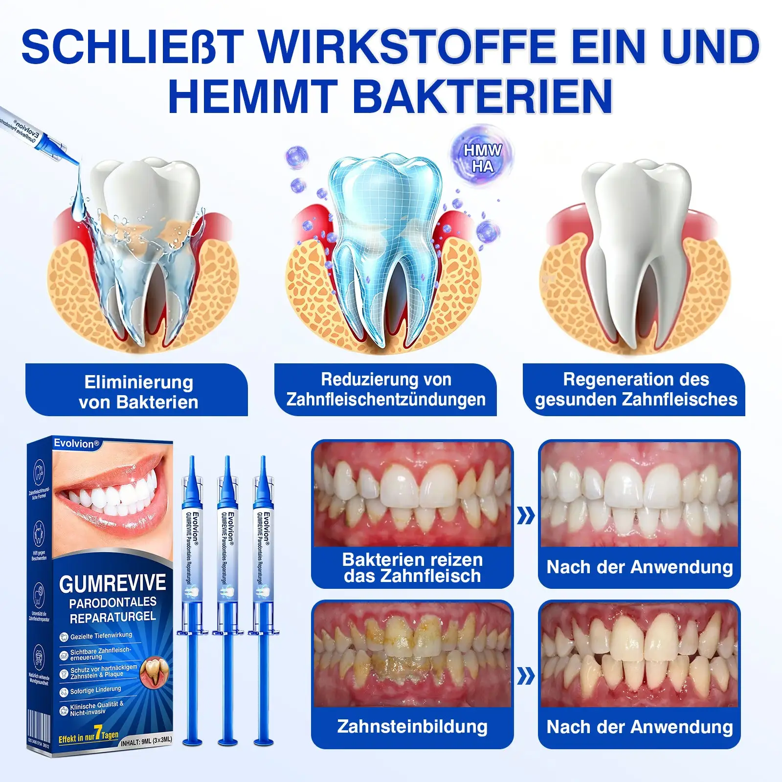 Evolvion® GumRevive Parodontales Reparaturgel