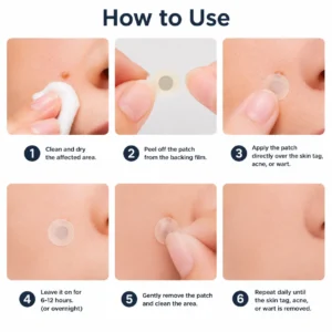 Healrize® 2-in-1 Microneedle & Hydrocolloid Patch