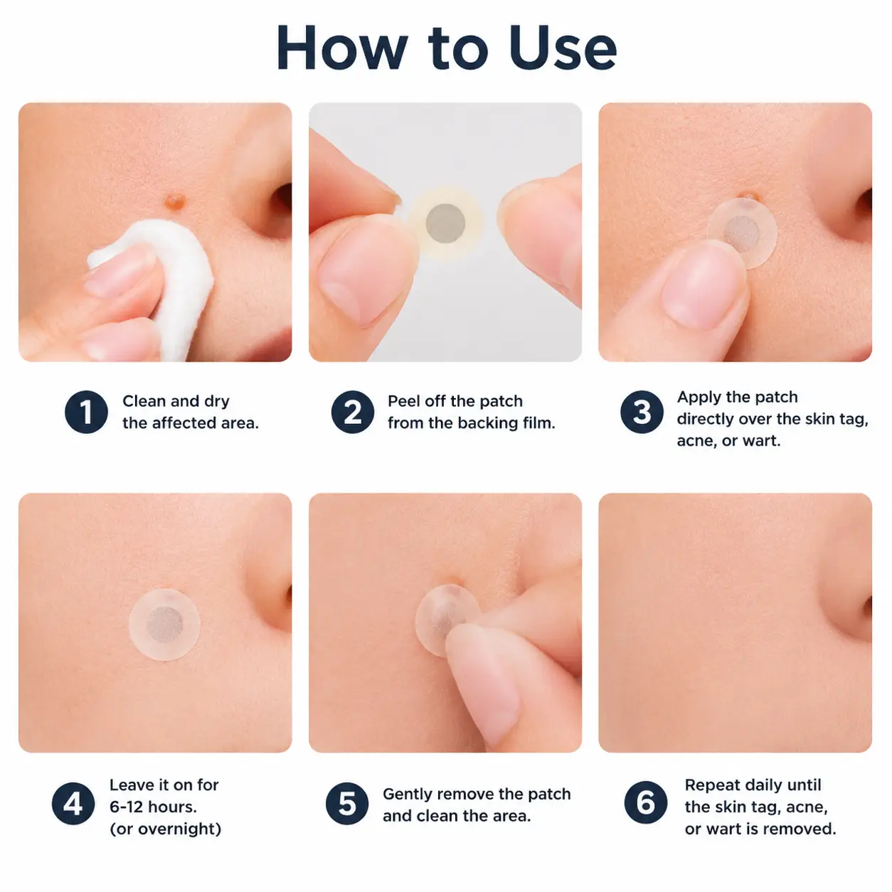 Healrize® 2-in-1 Microneedle & Hydrocolloid Patch
