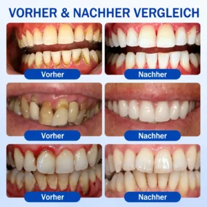 NATRAVOR® GumCare Pro | Zahnfleischpflege & Parodontal Gel