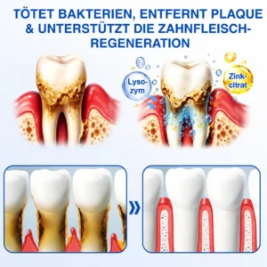 NATRAVOR® GumCare Pro | Zahnfleischpflege & Parodontal Gel