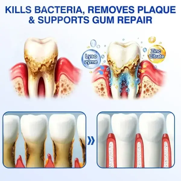 Dr.Era® GumRevive Advanced Gum Care Gel