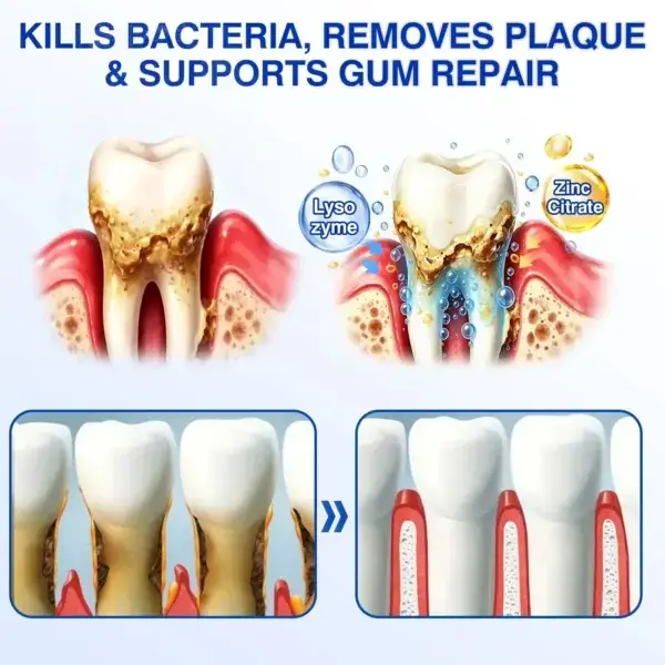 Evolvion® GumCare Pro