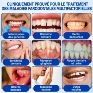 Gel Régénération Parodontale