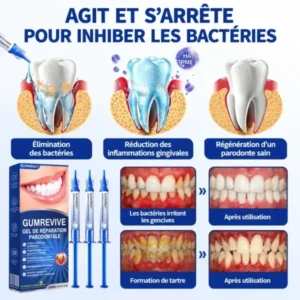 Gel Régénération Parodontale