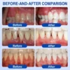 Pureluxo® GumRevive Periodontal Repair Gel