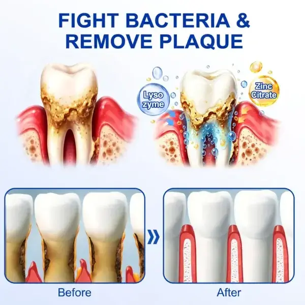 Pureluxo® GumRevive Periodontal Repair Gel