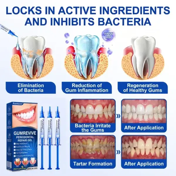 Pureluxo® GumRevive Periodontal Repair Gel