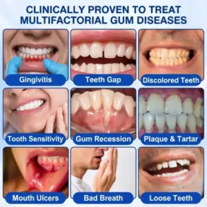 SOLAROZA® GumRevive Periodontal Repair Gel